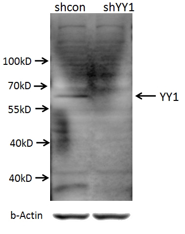A549 cells (shcontrol and shRNA of YY1) were subjected to SDS PAGE followed by western blot with Catalog No:117347 (YY1 antibody) at dilution of 1:1000.