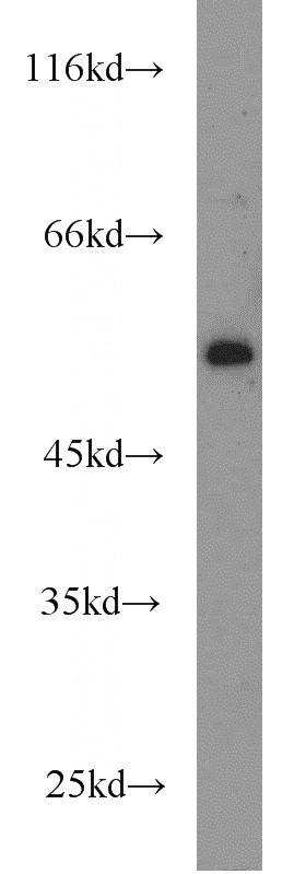 A2780 cells were subjected to SDS PAGE followed by western blot with Catalog No:113614(PBX1 antibody) at dilution of 1:500