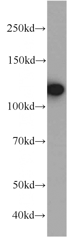 HeLa cells were subjected to SDS PAGE followed by western blot with Catalog No:110213(EFTUD2 antibody) at dilution of 1:1000