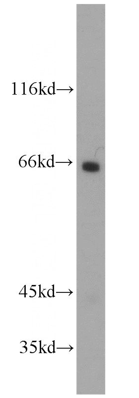 mouse kidney tissue were subjected to SDS PAGE followed by western blot with Catalog No:113094(Nectin 2 antibody) at dilution of 1:300