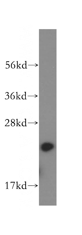 human colon tissue were subjected to SDS PAGE followed by western blot with Catalog No:108819(CAPS antibody) at dilution of 1:500