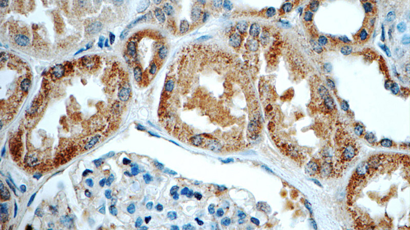 Immunohistochemistry of paraffin-embedded human kidney tissue slide using Catalog No:108610(C16orf84 Antibody) at dilution of 1:50 (under 40x lens)