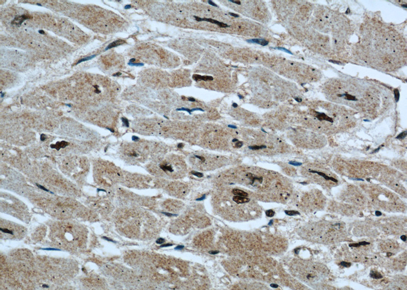 Immunohistochemical of paraffin-embedded human heart using Catalog No:114109(PPP3CA antibody) at dilution of 1:50 (under 40x lens)