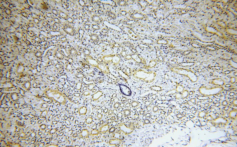 Immunohistochemical of paraffin-embedded human kidney using Catalog No:112481(MARK4 antibody) at dilution of 1:50 (under 10x lens)
