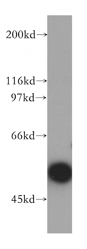 K-562 cells were subjected to SDS PAGE followed by western blot with Catalog No:112715(MNDA antibody) at dilution of 1:1000
