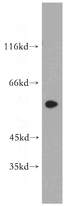 SH-SY5Y cells were subjected to SDS PAGE followed by western blot with Catalog No:110016(DRD2 antibody) at dilution of 1:200