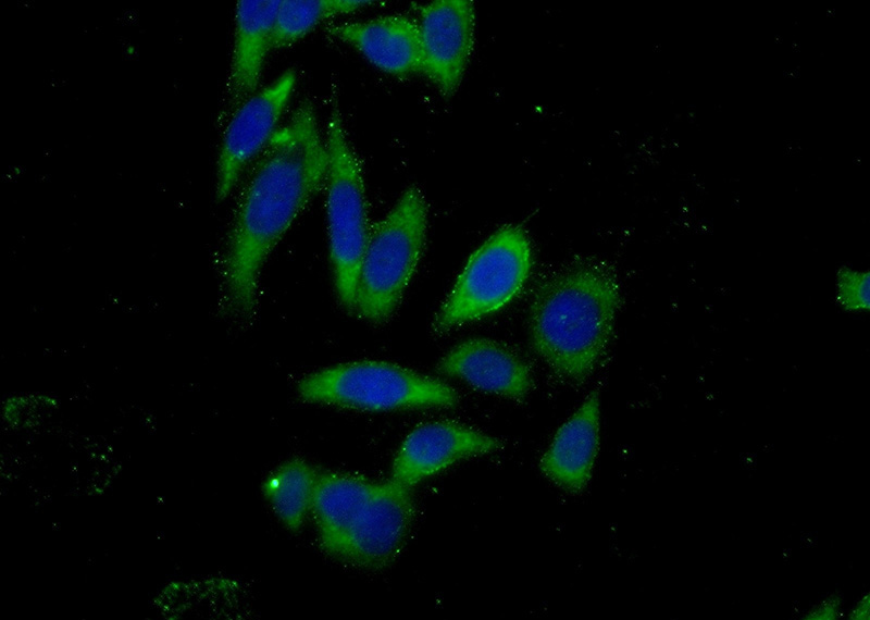Immunofluorescent analysis of (-20oc Ethanol) fixed PC-3 cells using Catalog No:110151(DZIP1 Antibody) at dilution of 1:50 and Alexa Fluor 488-congugated AffiniPure Goat Anti-Rabbit IgG(H+L)