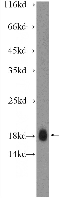 HeLa cells were subjected to SDS PAGE followed by western blot with Catalog No:116224(TR2IT1 Antibody) at dilution of 1:300