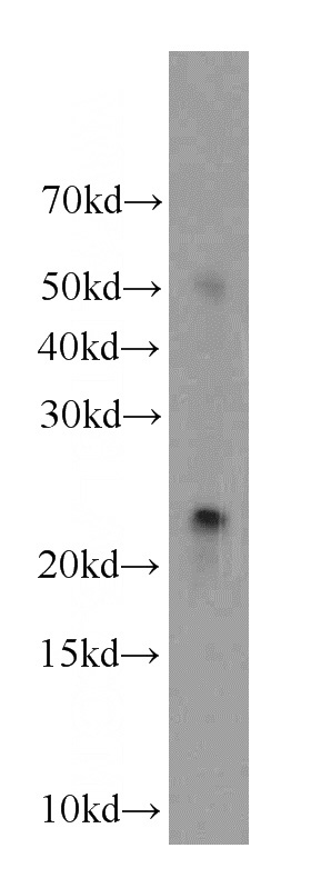 human testis tissue were subjected to SDS PAGE followed by western blot with Catalog No:113457(CTAG1A antibody) at dilution of 1:100