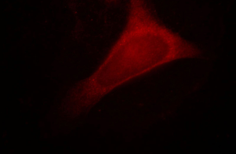 Immunofluorescent analysis of Hela cells, using RBBP9 antibody Catalog No: at 1:25 dilution and Rhodamine-labeled goat anti-mouse IgG (red).