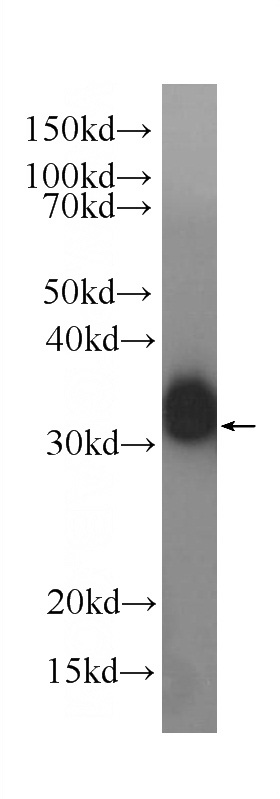 Recombinant protein were subjected to SDS PAGE followed by western blot with Catalog No:107396(IL28A Antibody) at dilution of 1:5000