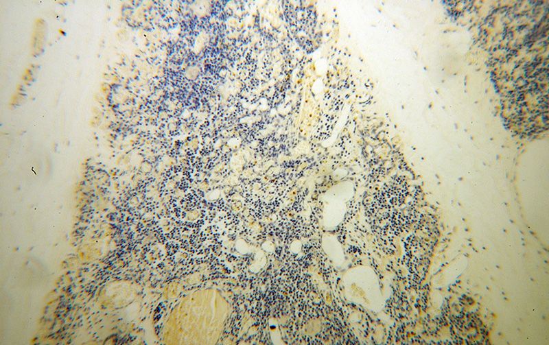Immunohistochemical of paraffin-embedded human thymus using Catalog No:114507(RACGAP1 antibody) at dilution of 1:100 (under 10x lens)