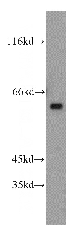 mouse testis tissue were subjected to SDS PAGE followed by western blot with Catalog No:114112(PPP3CC antibody) at dilution of 1:500