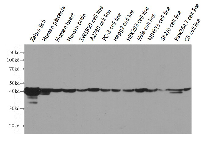 Western blot analysis of beta actin in various tissues and cell lines using Proteintech antibody HRP-60008 at a dilution of 1:5000.