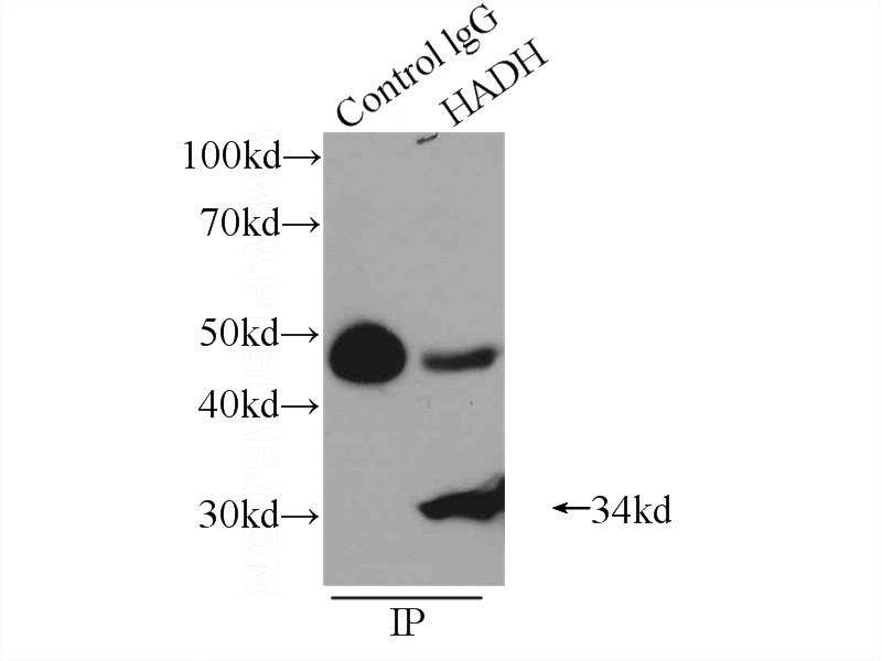 IP Result of anti-HADH (IP:Catalog No:111332, 3ug; Detection:Catalog No:111332 1:700) with HepG2 cells lysate 400ug.