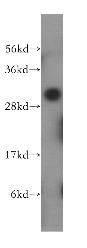 MCF7 cells were subjected to SDS PAGE followed by western blot with Catalog No:113983(PNPO antibody) at dilution of 1:500