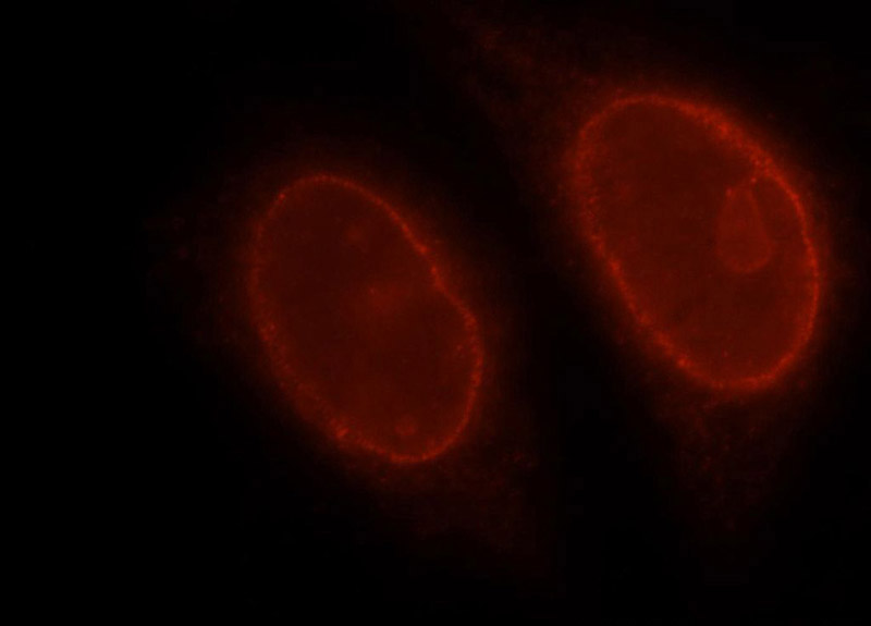 Immunofluorescent analysis of Hela cells, using RAG2 antibody Catalog No:114525 at 1:25 dilution and Rhodamine-labeled goat anti-rabbit IgG (red).