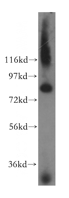 human brain tissue were subjected to SDS PAGE followed by western blot with Catalog No:109432(CNOT10 antibody) at dilution of 1:500