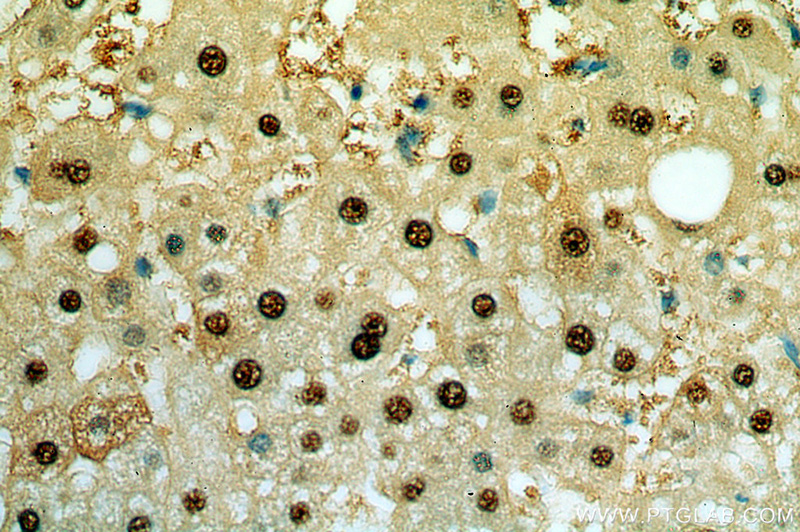 Immunohistochemical of paraffin-embedded human liver using Catalog No:111179(GSTA1 antibody) at dilution of 1:50 (under 40x lens)