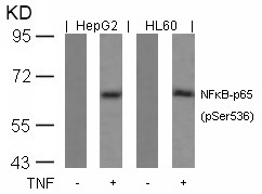 Western blot analysis of extracts from HepG2 and HL60 cells untreated or treated with TNF using NF-κB p65 (Phospho-Ser536) Antibody .