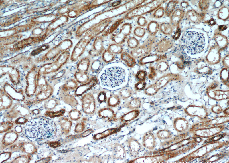 Immunohistochemistry of paraffin-embedded human kidney slide using Catalog No:108058(ANGPTL4 Antibody) at dilution of 1:50