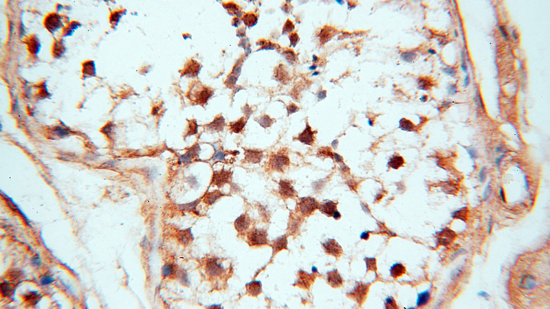 Immunohistochemical of paraffin-embedded human testis using Catalog No:109829(DDX3Y antibody) at dilution of 1:50 (under 40x lens)