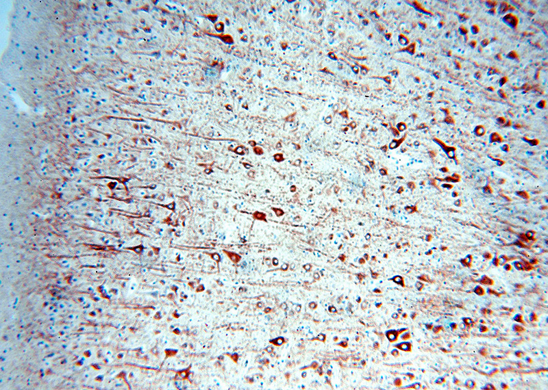 Immunohistochemical of paraffin-embedded human brain using Catalog No:112474(MAP2 antibody) at dilution of 1:100 (under 10x lens). Heat mediated antigen retrieved with Citric acid buffer, pH6.0.