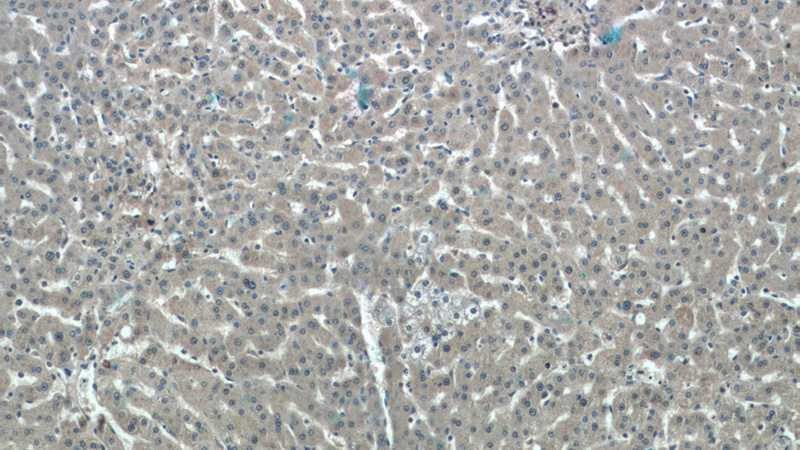 Immunohistochemistry of paraffin-embedded human liver tissue slide using Catalog No:108385(BCHE Antibody) at dilution of 1:50 (under 10x lens)