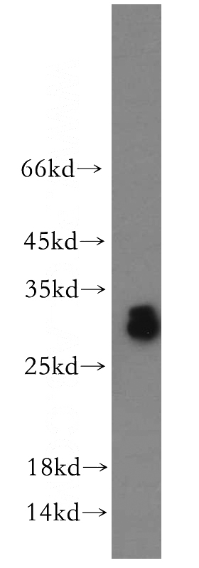 human testis tissue were subjected to SDS PAGE followed by western blot with Catalog No:108216(ASB9 antibody) at dilution of 1:300