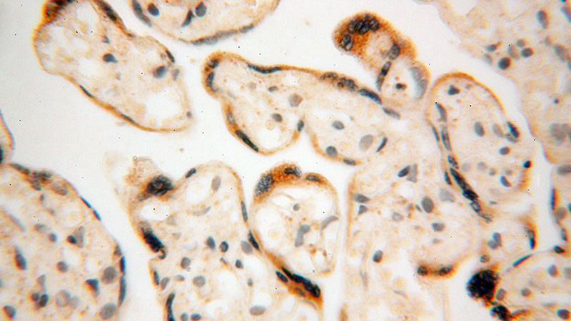 Immunohistochemical of paraffin-embedded human placenta using Catalog No:110850(GALNTL2 antibody) at dilution of 1:50 (under 40x lens)