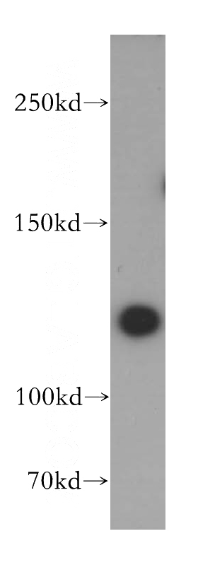 HeLa cells were subjected to SDS PAGE followed by western blot with Catalog No:115062(SAPS1 antibody) at dilution of 1:500