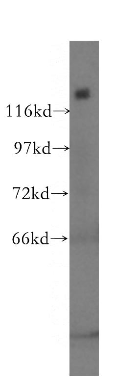 HEK-293 cells were subjected to SDS PAGE followed by western blot with Catalog No:115137(SF3B2 antibody) at dilution of 1:400