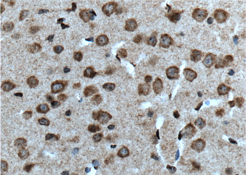 Immunohistochemistry of paraffin-embedded mouse brain tissue slide using Catalog No:108757(CACNA1B Antibody) at dilution of 1:100 (under 40x lens). heat mediated antigen retrieved with Tris-EDTA buffer(pH9).