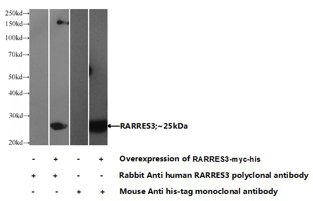 Transfected HEK-293 cells were subjected to SDS PAGE followed by western blot with Catalog No:114470(RARRES3 Antibody) at dilution of 1:1000
