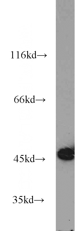 HEK-293 cells were subjected to SDS PAGE followed by western blot with Catalog No:111101(GMPPA antibody) at dilution of 1:1000