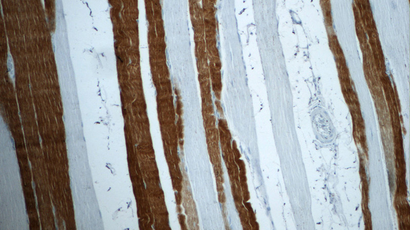 Immunohistochemistry of paraffin-embedded human skeletal muscle tissue slide using Catalog No:116152(TNNI2 Antibody) at dilution of 1:50 (under 10x lens)