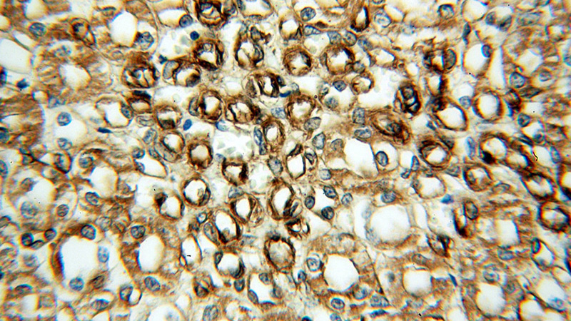 Immunohistochemical of paraffin-embedded human kidney using Catalog No:113259(nNOS antibody) at dilution of 1:100 (under 40x lens)