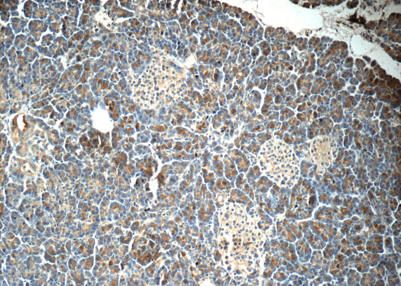 Immunohistochemistry of paraffin-embedded human pancreas tissue slide using Catalog No:110109(DNAJC21 Antibody) at dilution of 1:50 (under 10x lens)