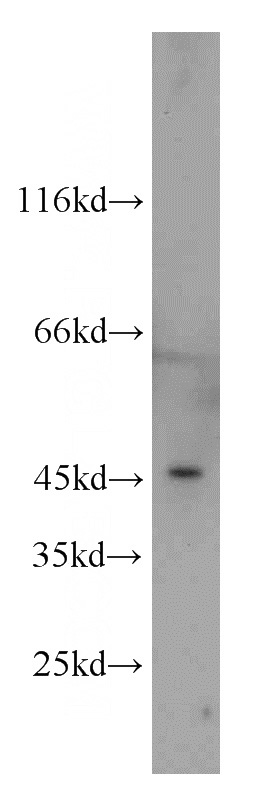 A431 cells were subjected to SDS PAGE followed by western blot with Catalog No:110695(FOXD4L6 antibody) at dilution of 1:1000