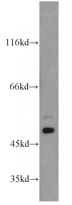 A431 cells were subjected to SDS PAGE followed by western blot with Catalog No:109791(KRT13-Specific antibody) at dilution of 1:200