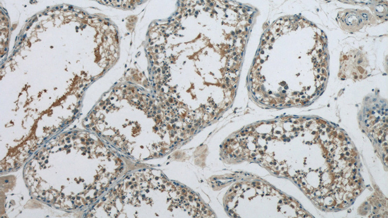 Immunohistochemistry of paraffin-embedded human testis tissue slide using Catalog No:112524(MEX3C Antibody) at dilution of 1:50 (under 10x lens)