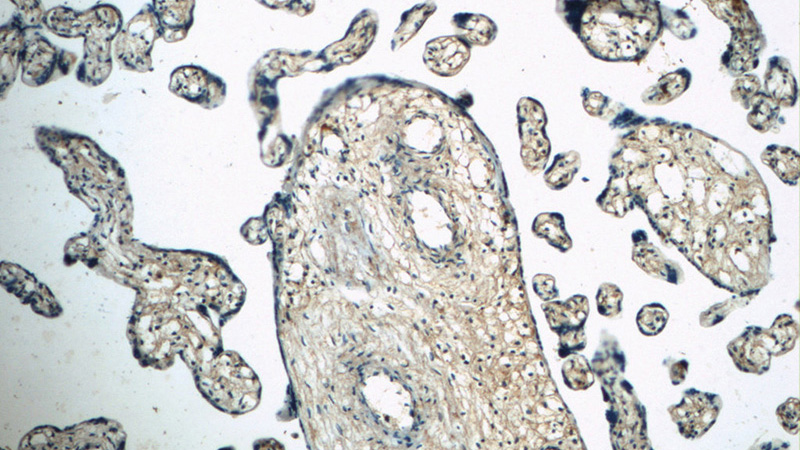 Immunohistochemistry of paraffin-embedded human placenta slide using Catalog No:113154(NFKB1 Antibody) at dilution of 1:50 (under 10x lens)