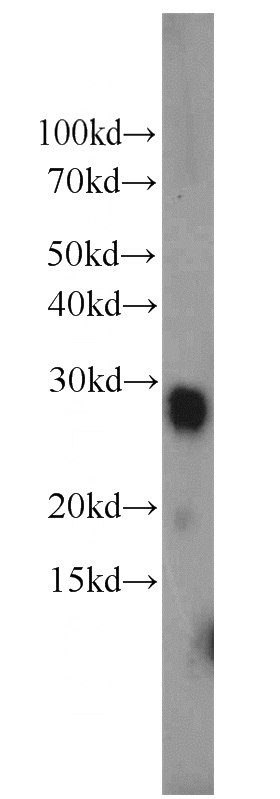 human testis tissue were subjected to SDS PAGE followed by western blot with Catalog No:112403(LY6K antibody) at dilution of 1:500