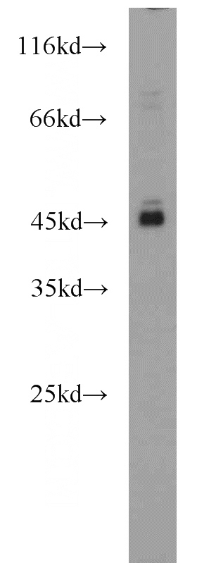 K-562 cells were subjected to SDS PAGE followed by western blot with Catalog No:107855(AIM2 antibody) at dilution of 1:1000