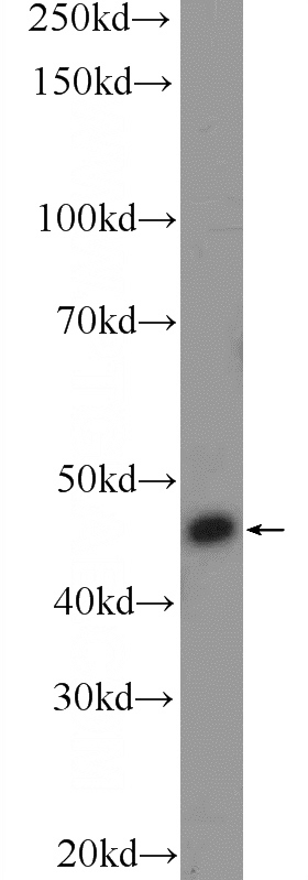 Jurkat cells were subjected to SDS PAGE followed by western blot with Catalog No:115417(SMAD3 Antibody) at dilution of 1:600