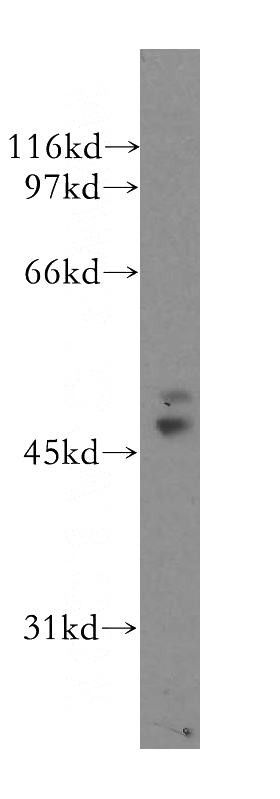 A431 cells were subjected to SDS PAGE followed by western blot with Catalog No:116719(VASP antibody) at dilution of 1:1000