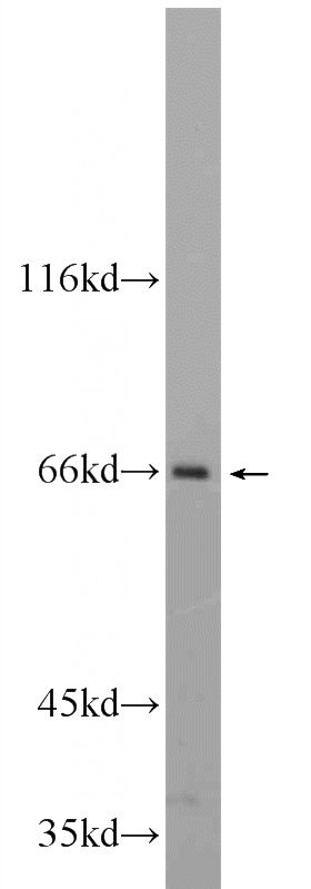 HepG2 cells were subjected to SDS PAGE followed by western blot with Catalog No:110494(EVI2B Antibody) at dilution of 1:1000