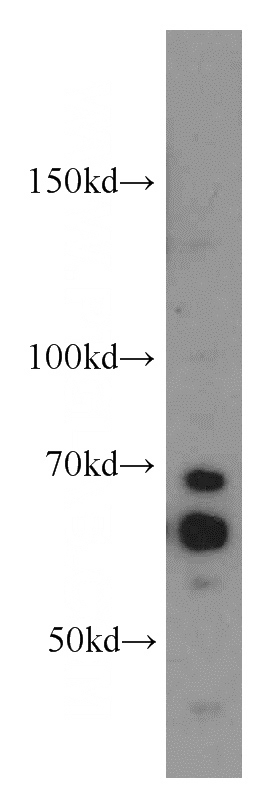 HepG2 cells were subjected to SDS PAGE followed by western blot with Catalog No:109096(CDC25A antibody) at dilution of 1:1500
