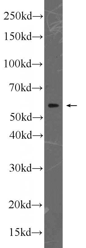 HeLa cells were subjected to SDS PAGE followed by western blot with Catalog No:108884(CAT antibody) at dilution of 1:1000