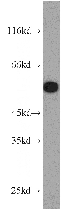 HeLa cells were subjected to SDS PAGE followed by western blot with Catalog No:115725(STK4 antibody) at dilution of 1:1000